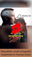 neuralink a small computer implented in human brain