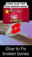 glue to fix boken bones